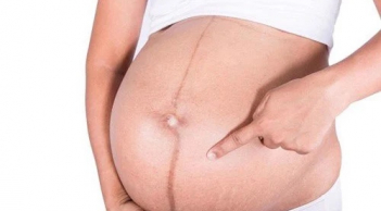 Đường sọc nâu mẹ bầu nào cũng có trên bụng khi mang thai tiết lộ điều gì?