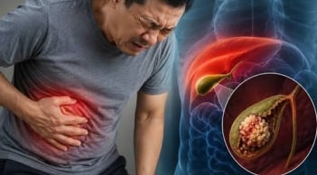 3 dấu hiệu cảnh báo viêm túi mật nặng