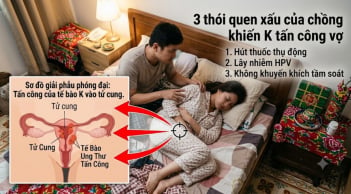 3 thói quen xấu của chồng khiến K tấn công vợ