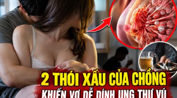 2 thói xấu của chồng khiến vợ dễ dính ung thư vú