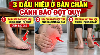 3 dấu hiệu ở bàn chân cảnh báo đột quỵ, số 1 cảnh báo cao