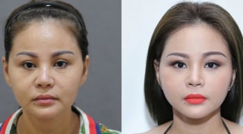 Nhan sắc từng phẫu thuật thẩm mỹ của vợ cũ Duy Phương - Lê Giang ở độ tuổi U50