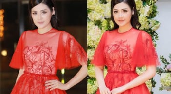 Đang rộ tin hẹn hò em chồng Hà Tăng, Á hậu Tú Anh lại lộ mặt cứng đờ nghi phẫu thuật thẩm mỹ