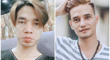 Hoảng hồn với nhan sắc 'xuống cấp' của Lệ Rơi vì phẫu thuật thẩm mỹ 'hỏng'?
