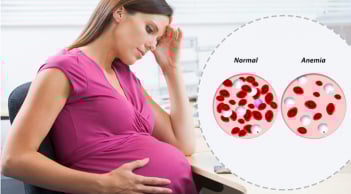 9 loại thực phẩm giúp ngăn ngừa tình trạng thiếu máu cho bà bầu