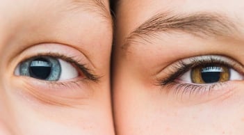 5 lý do khiến da mắt của bạn nhiều nếp nhăn sớm, đừng quên thay đổi ngay!