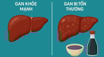 Cảnh báo: Loại gia vị quen thuộc này có thể âm thầm hại gan mà nhiều người Việt chưa biết