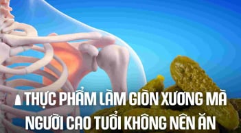 3 loại nước là 'vua rút cạn canxi, uống nhiều xương giòn, dễ gãy