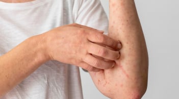 8 dấu hiệu cảnh báo bạn đang mắc bệnh thận giai đoạn nặng: Có 1 cũng nên đi khám gấp