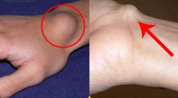 Sáng sớm thấy 4 dấu hiệu này là tế bào K đang tấn công, ăn mòn cơ thể