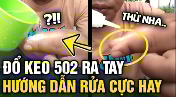 Cách gỡ keo 502 dính trên tay và đồ dùng nhanh nhất, không lo phồng rộp