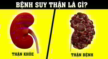 2 việc làm buổi tối trước khi ngủ cực kỳ hại thận: Nhiều người chạy thận vẫn không biết lý do