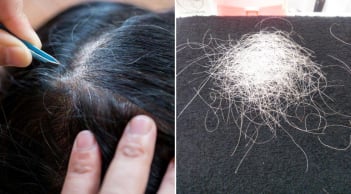 Thường xuyên nhổ tóc bạc, tóc sâu gây ra 4 tác hại này