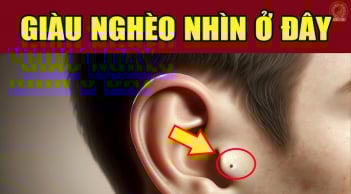 5 nốt ruồi phá tài, ai có 1 cũng khánh kiệt: Đặc biệt vị trí thứ 2 cả người và của đều lao đao