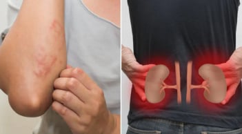 Cơ thể có 7 dấu hiệu này, cảnh báo bệnh thận, suy thận đang đến gần
