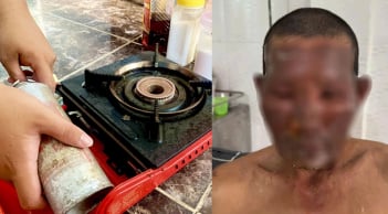 Bình gas mini phát nổ, 8 người nhập viện, lưu ý cách dùng để tránh họa bình gas mini