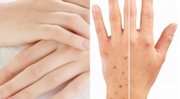 Mu bàn tay tiết lộ bí mật sống thọ: 4 dấu hiệu ai cũng nên kiểm tra