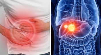 “2 đau 1 vàng” dấu hiệu cảnh báo ung thư gan đang âm thầm phát triển: Chủ quan tính mạng tính từng ngày