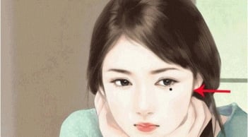 3 nốt ruồi phá tài: Trẻ thì lận đận công danh, già thì hao tài nghèo khổ