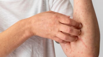 4 dấu hiệu cảnh báo K sớm: Có 1 cũng nên đi khám sớm