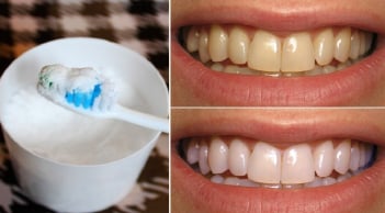 Đánh răng bằng thứ này, làm sạch mảng bám, tẩy trắng răng, không mòn men răng