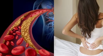 Người gầy vẫn bị mỡ máu cao vì những lý do này
