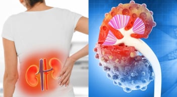 8 dấu hiệu suy thận nhẹ bị nhiều người bỏ qua, chỉ tới lúc nặng mới biết
