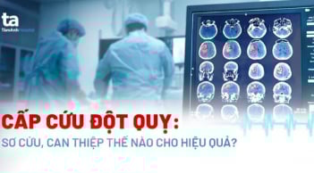Cách sơ cứu đột quỵ tại nhà đúng cách nhất