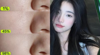 Qua 30 tuổi, nhớ áp dụng 7 cách này để da căng mướt, thu nhỏ lỗ chân lông