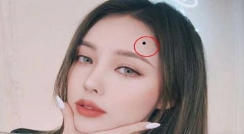 Nốt ruồi phát tài nằm ở đâu? Thầy tướng số tiết lộ: Ai sở hữu, tiền vào như nước, giàu sang khó tránh