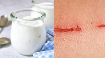 Nghiên cứu mới: Làm Gel trị thương từ sữa chua