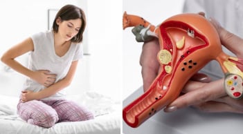 Dấu hiểu cảnh báo K cổ tử cung sớm: Phụ Nữ u 40 đang khoẻ mạnh cũng chớ xem thường