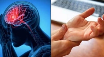 Dấu hiệu cảnh báo đột quỵ trước một tuần tuyệt đối đừng bỏ qua