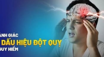 7 dấu hiệu cảnh báo đột quỵ trước 1 tuần: Nhận biết sớm để cứu mạng