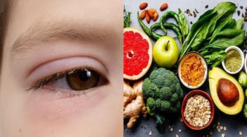 Mắt xuất hiện 3 dấu hiệu bất thường, coi chừng cholesterol trong máu quá cao: Khi rửa mặt nhất định phải chú ý