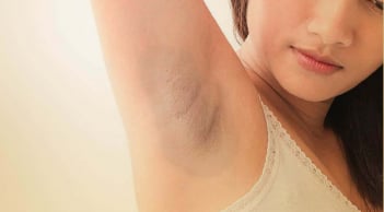 7 mẹo là “cứu tinh” giúp bạn vừa trị thâm, vừa khử mùi hiệu quả