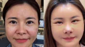 Kim Oanh lên tiếng sau khi gây tranh cãi vì phẫu thuật thẩm mỹ cả gương mặt