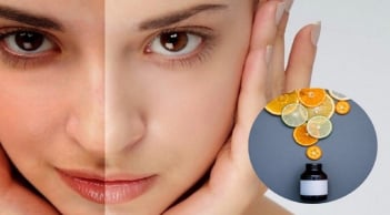 Vitamin C và những sai lầm thường gặp khi chăm sóc da