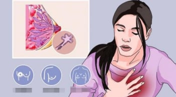 4 loại ung thư có tỷ lệ sống sót gần 100%, trong đó có ung thư vú – Đừng vội từ bỏ điều trị