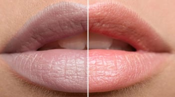 Bí quyết giảm thâm môi tự nhiên ngay tại nhà cực đơn giản không tốn tiền đi spa