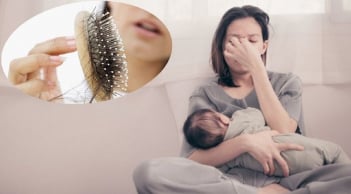 5 mẹo đơn giản để giảm tình trạng rụng tóc sau sinh