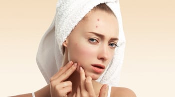 3 nguyên tắc cơ bản khi giảm sưng mụn viêm giúp da khỏe và nhanh láng mịn