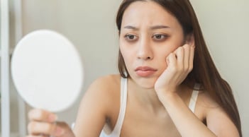 Chuyên gia bật mí tuyệt chiêu đỡ thâm và bọng mắt nhanh chóng