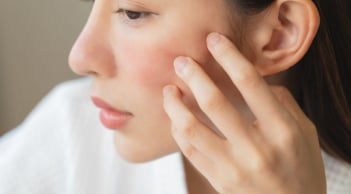 4 thói quen tưởng chừng vô hại nhưng lại khiến da dễ sạm nám