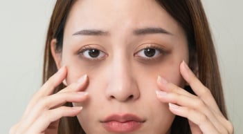 10 cách 'xóa sổ' quầng thâm mắt hiệu quả tại nhà, không cần mỹ phẩm đắt tiền hay ra spa