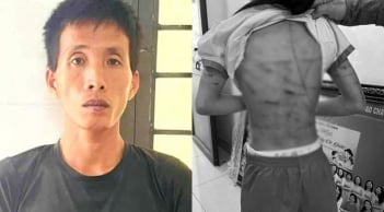 Vụ bé gái lớp 5 nghi bị bố dượng bạo hành: Hé lộ thêm nhiều tình tiết gây phẫn nộ dư luận