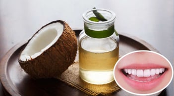 Súc miệng bằng dầu dừa có 3 lợi ích tuyệt vời, ai cũng cần