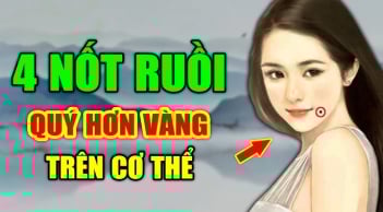 4 nốt ruồi quý hơn Vàng cực kỳ may mắn: Ai có được cả đời viên mãn