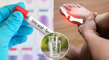 4 cách đào thải axit uric ra khỏi cơ thể nhanh chóng