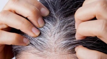 Thiếu vitamin nào khiến tóc bạc sớm? Cách bổ sung để ngăn tóc bạc hiệu quả